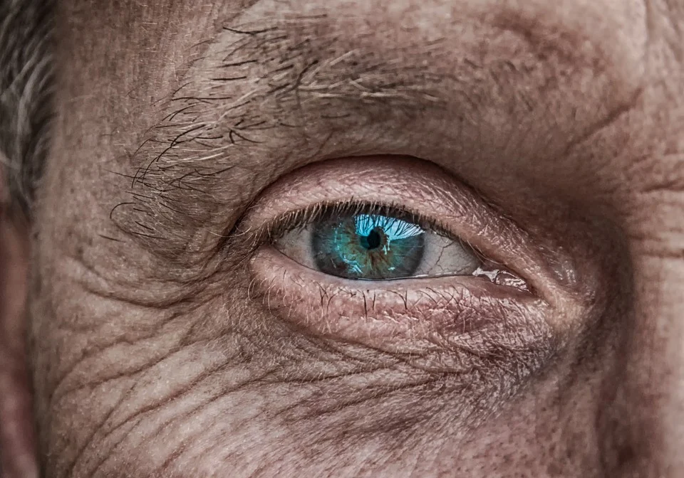 Amžinė geltonosios dėmės degeneracija – klastinga su amžiumi atsirandanti akių liga, kuri gali lemti apakimą